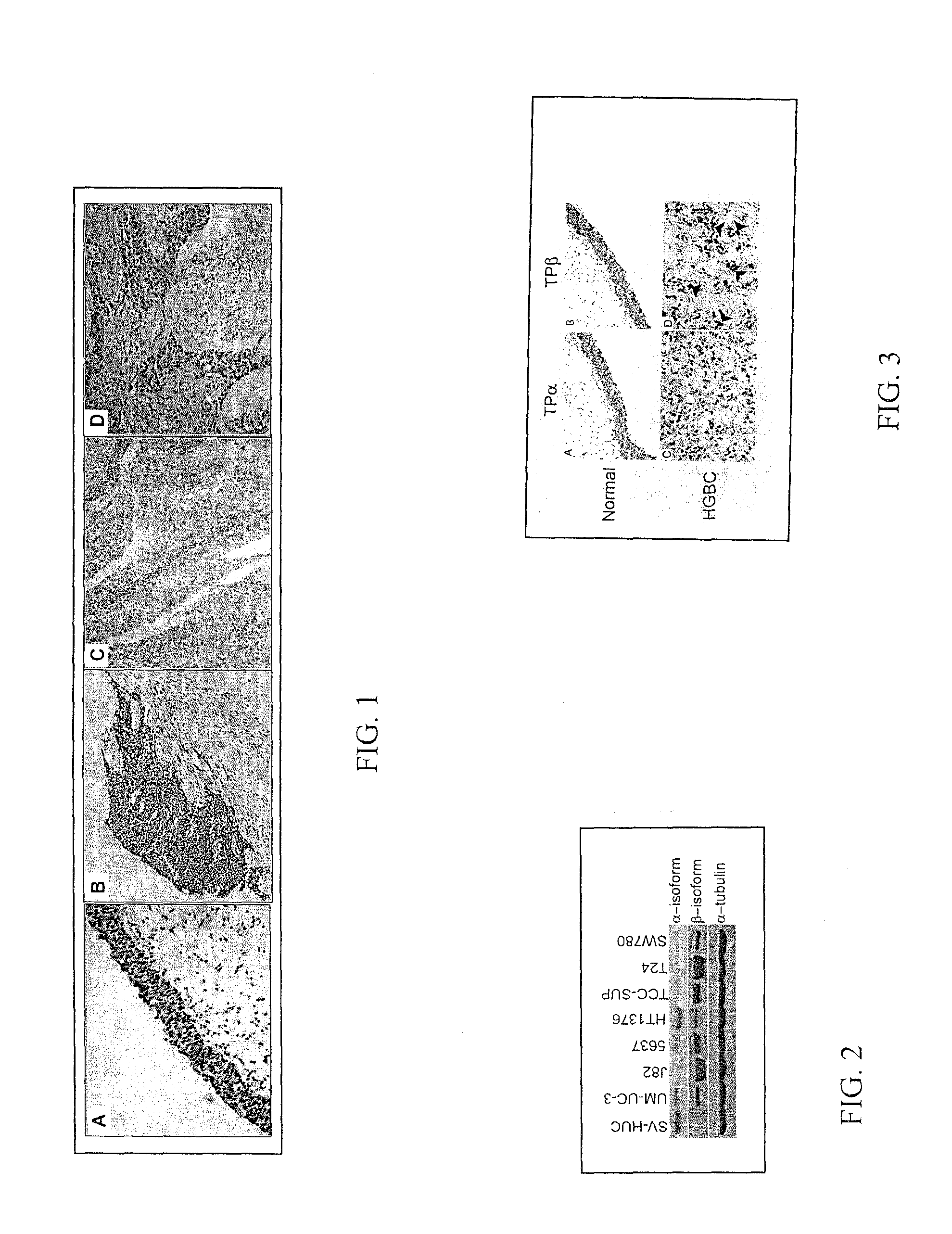 Methods for the Treatment of Cancers