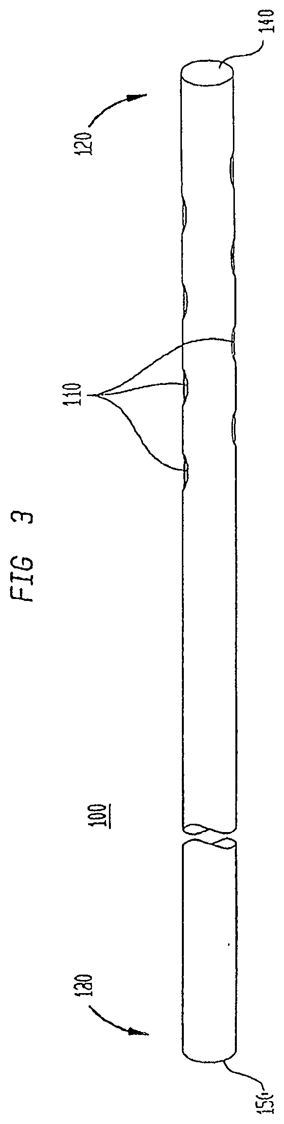 Methods and devices to ameliorate vascular obstruction