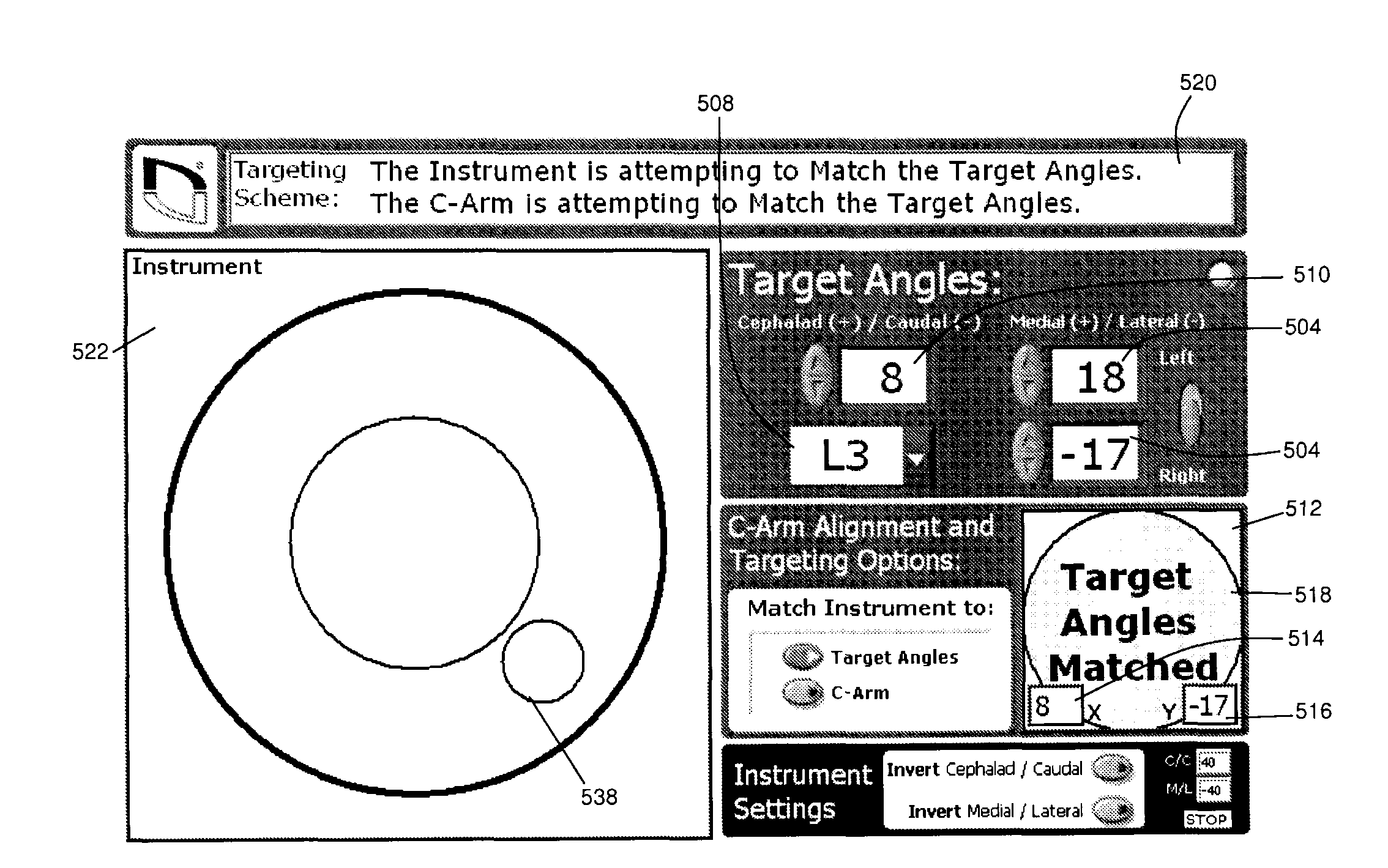 Surgical trajectory monitoring system and related methods