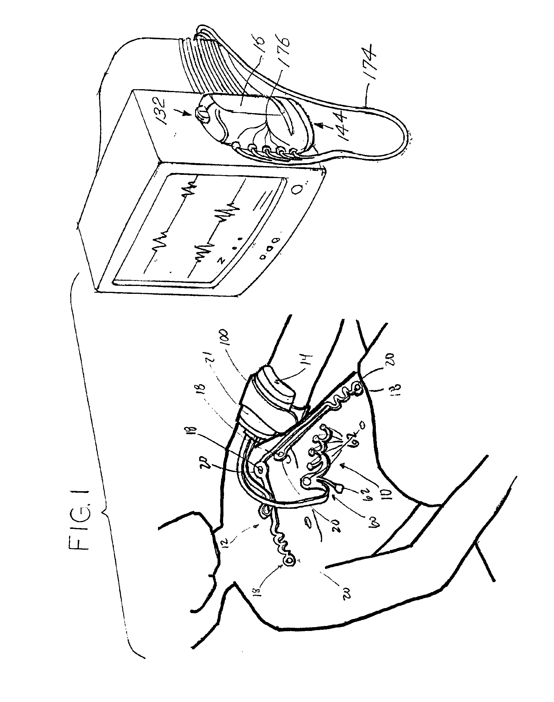 Wireless ECG system