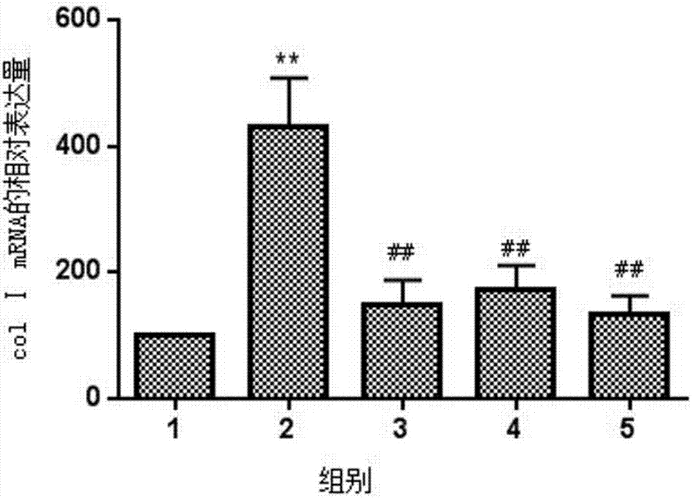 Application of honeysuckle flower extract extracted with petroleum ether to preparation of pulmonary fibrosis treatment drug