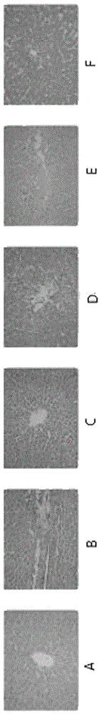 Application of pholidota chinensis lindl. polysaccharides to preparation of hepatoprotective