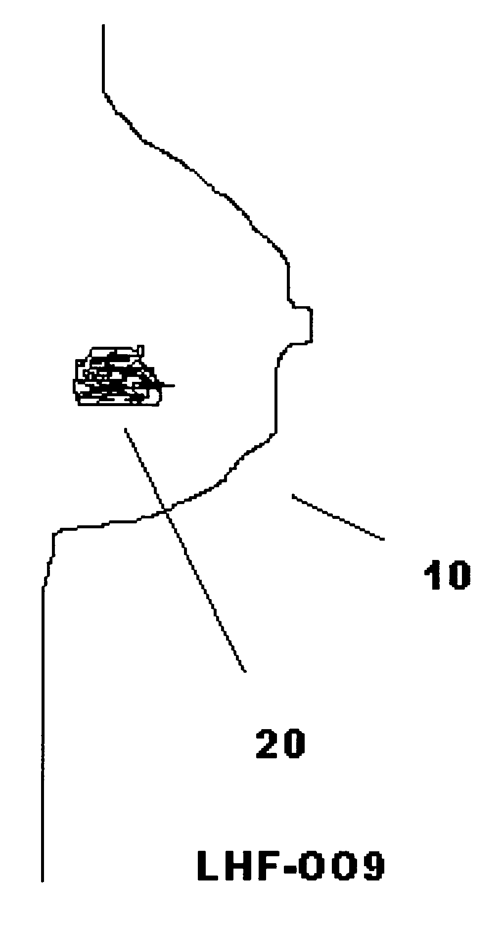 Extracellular matrix  as surgical adjunct in a lumpectomy procedure