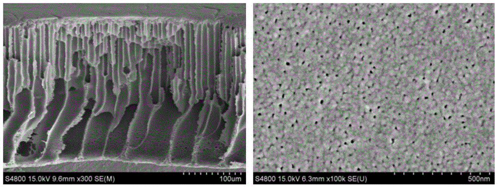 A preparation method of polyethersulfone ultrafiltration membrane with improved permeability and selectivity at the same time