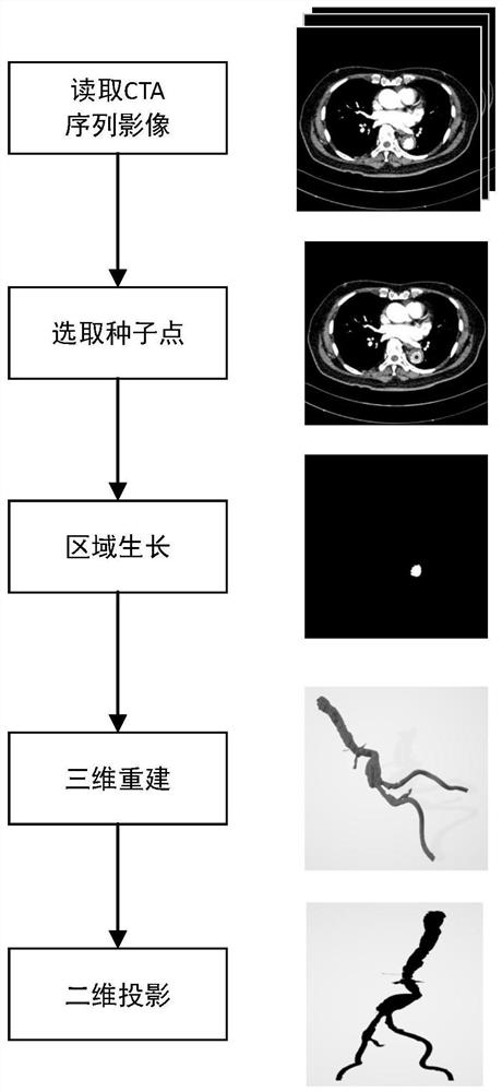 Blood vessel registration method, system and device for intravascular aneurysm operation