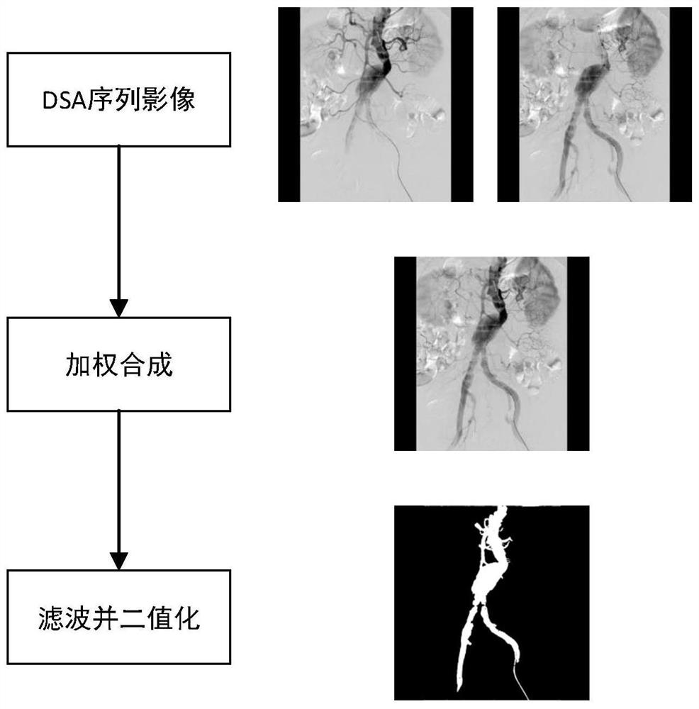 Blood vessel registration method, system and device for intravascular aneurysm operation