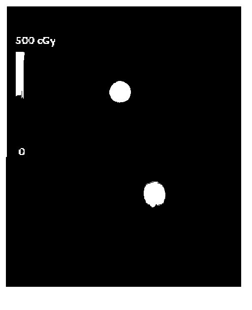 Method for generating distribution image used for observing cervix tumour radiotherapy total dose