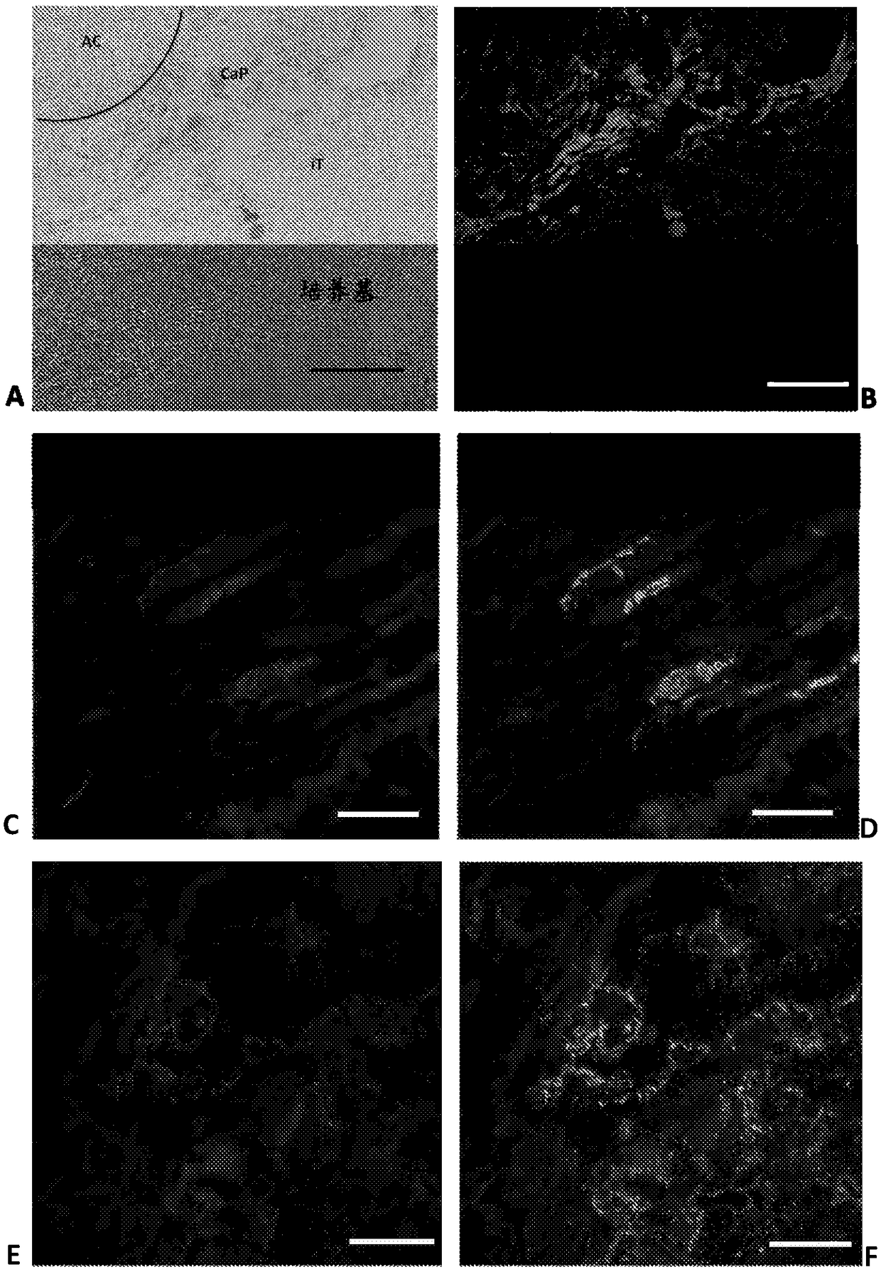 Treatment of vascular calcification