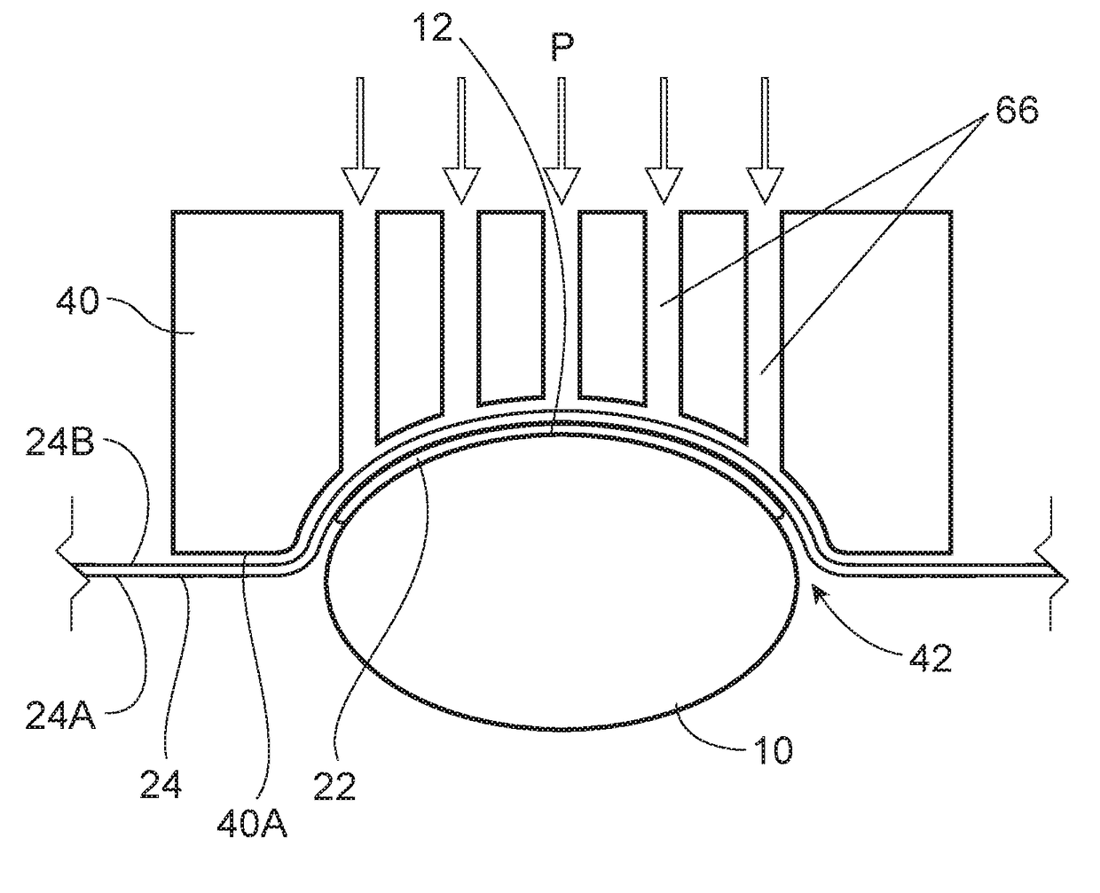 Method and apparatus for applying a material onto articles with a pre-distorted transfer component