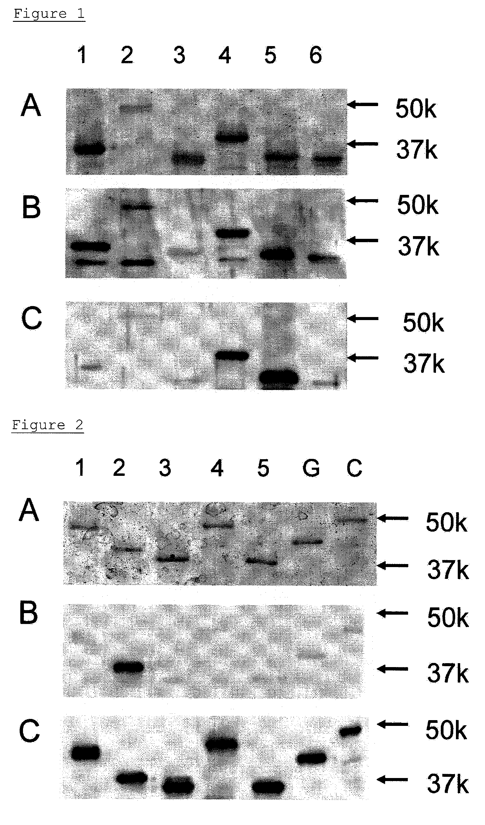 Method for detecting gynecologic cancer