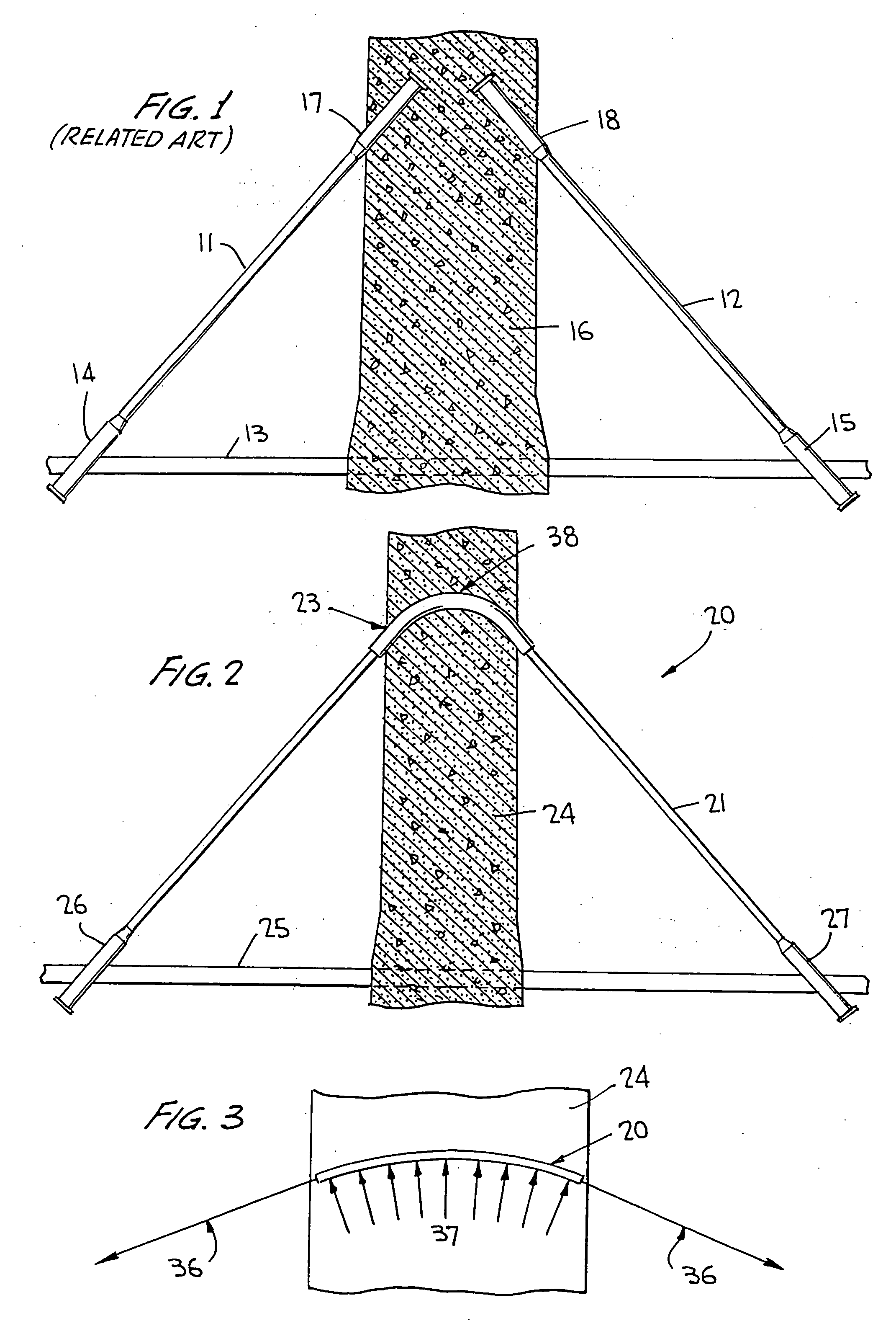 Cable-stay cradle system