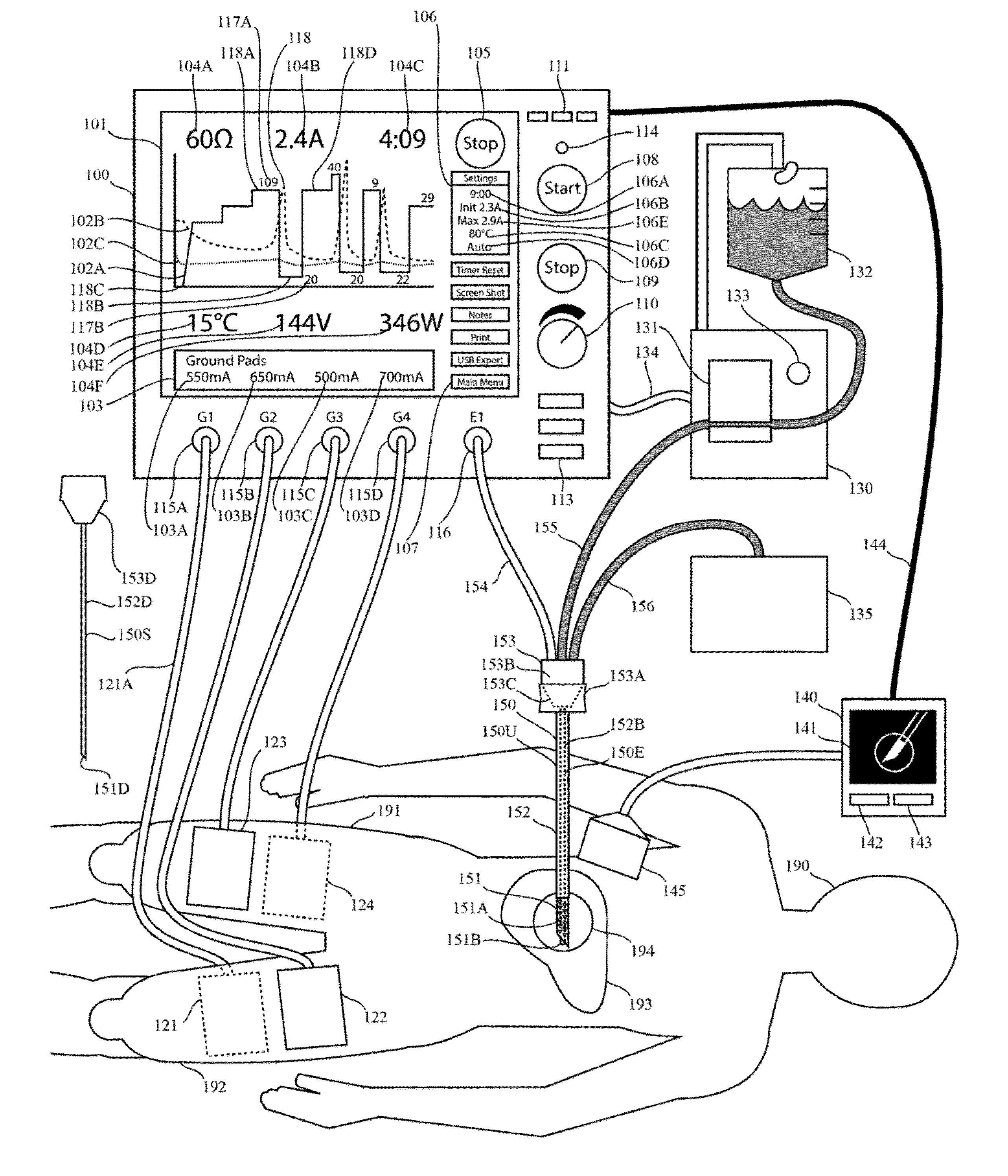 Electrosurgical generator