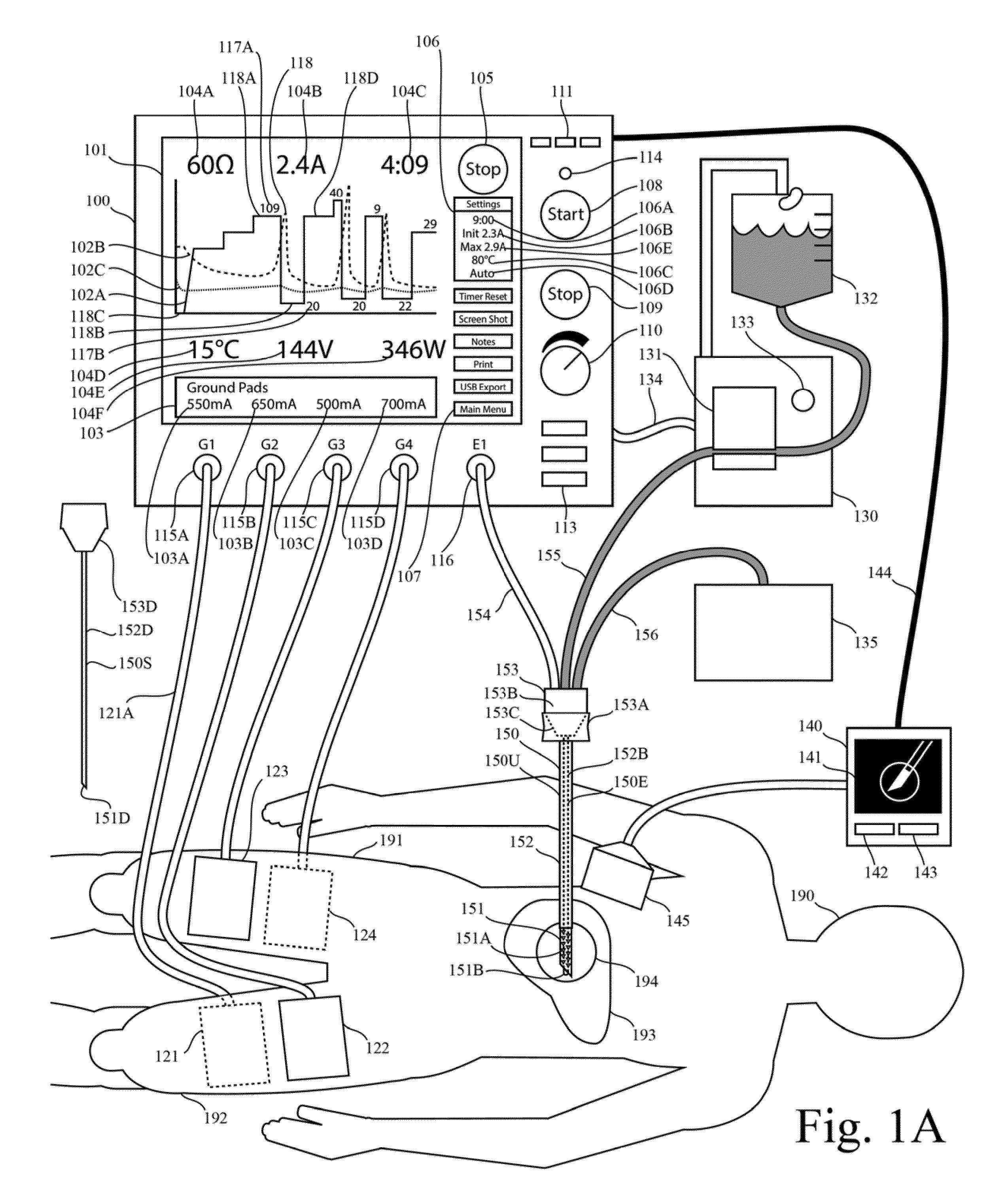 Electrosurgical generator