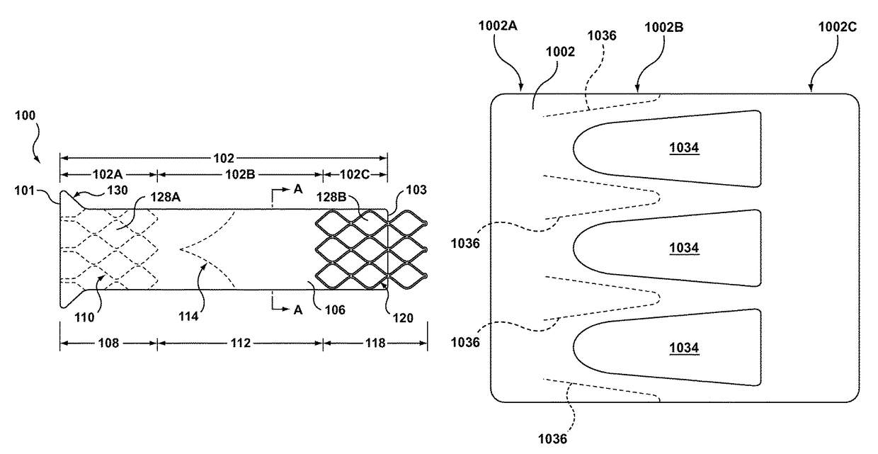 Segmented transcatheter valve prosthesis having an unsupported valve segment