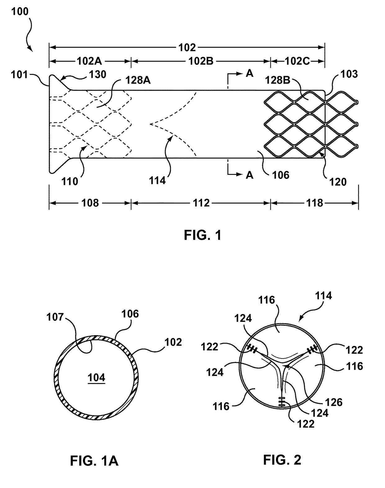 Segmented transcatheter valve prosthesis having an unsupported valve segment