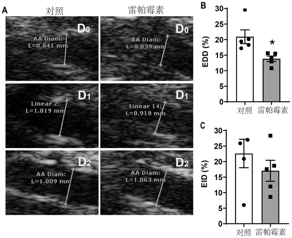 Application of NADPH oxidase 2 as therapeutic target in preparation of medicine for treating vascular dysfunction