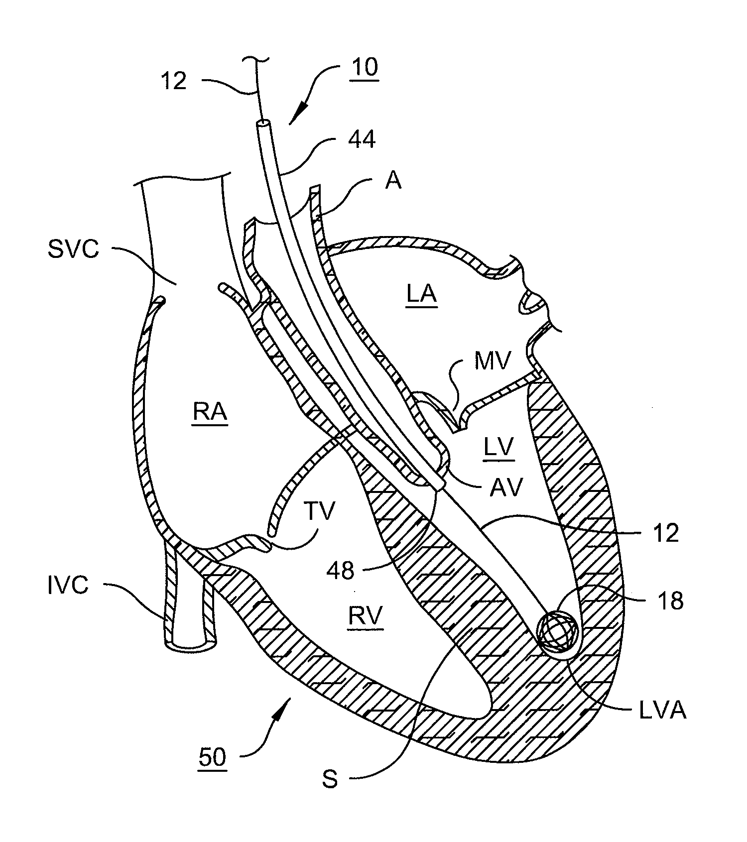 Anatomic device delivery and positioning system and method of use