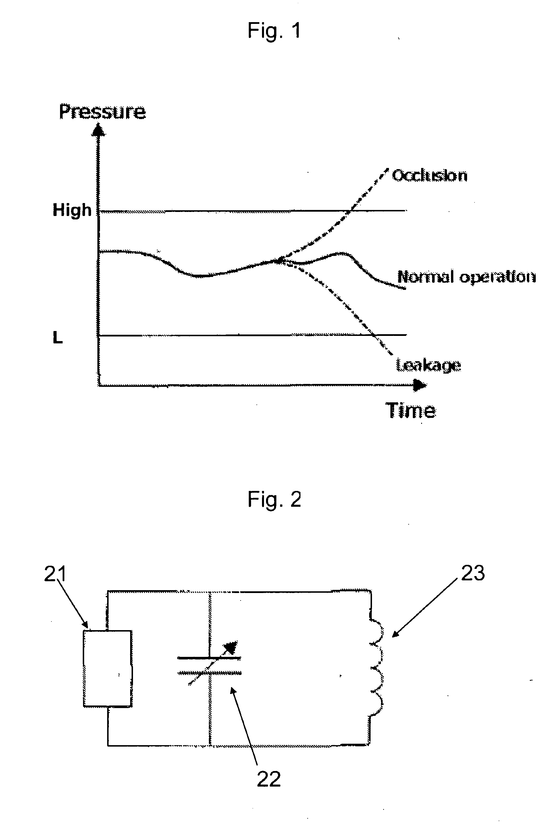 Medical device with value sensor