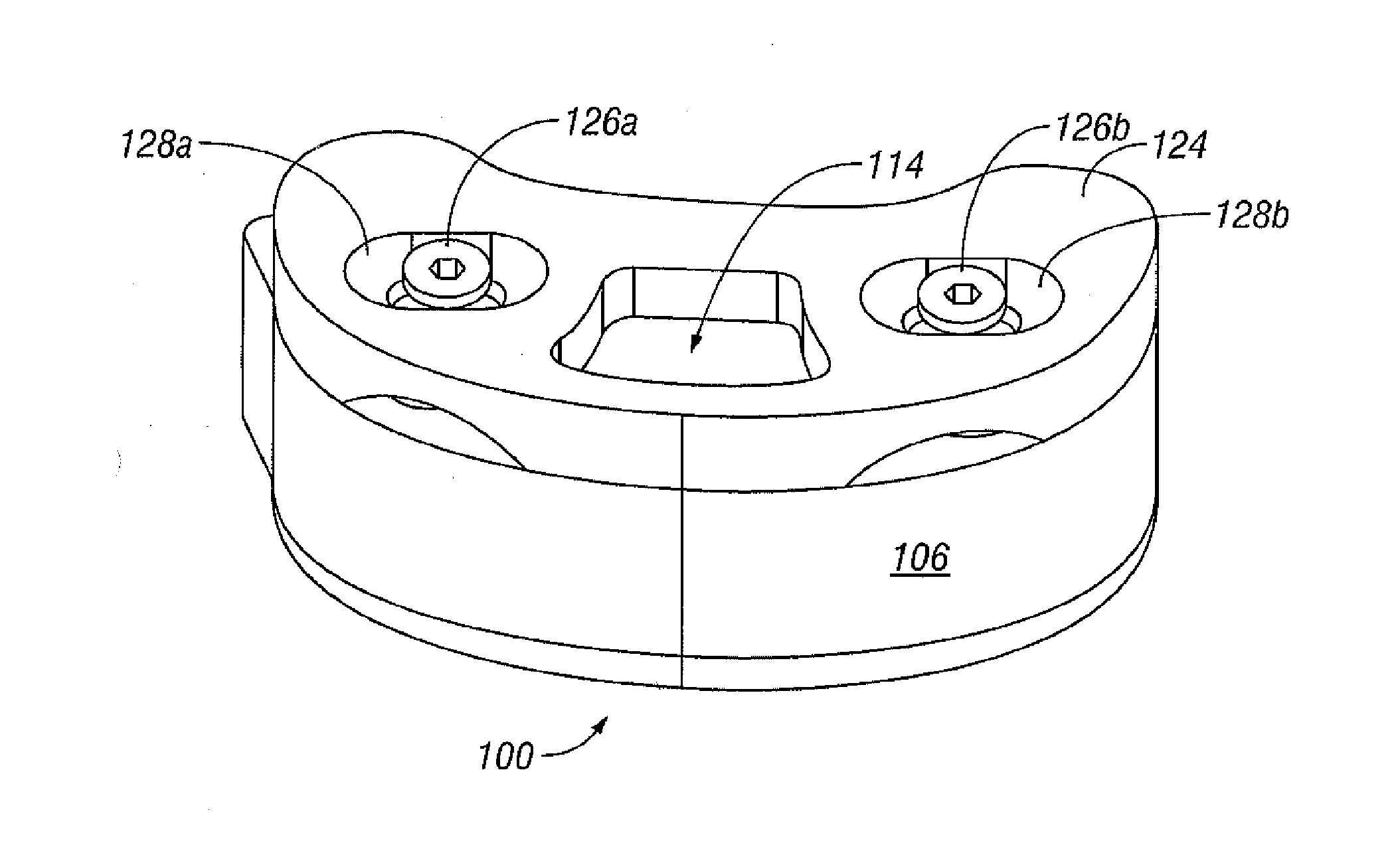 Selectively Expanding Spine Cage, Hydraulically Controllable In Three Dimensions for Vertebral Body Replacement