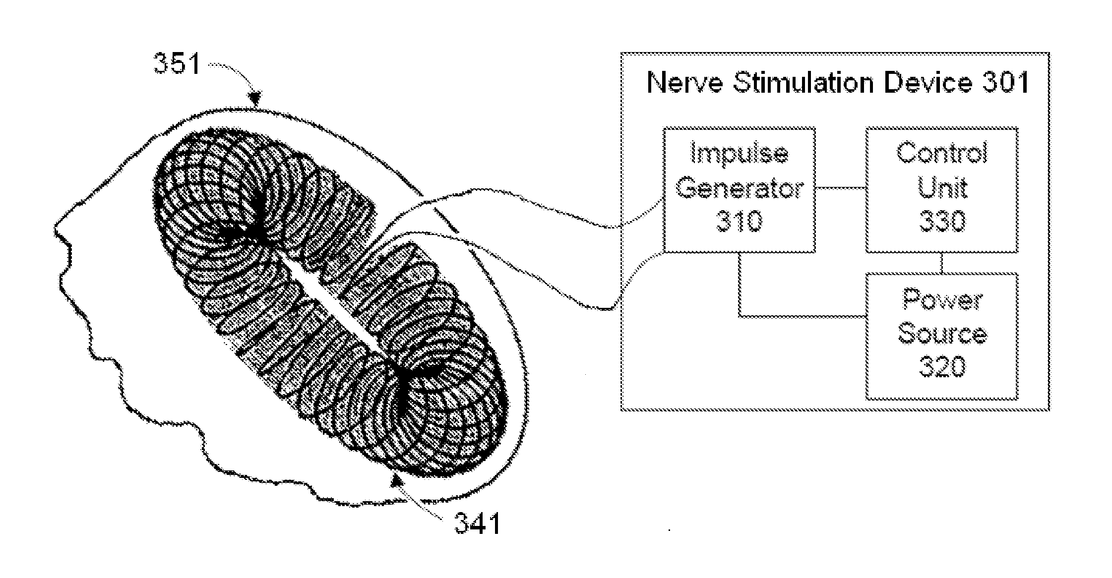 Nerve stimulation methods for averting imminent onset or episode of a disease