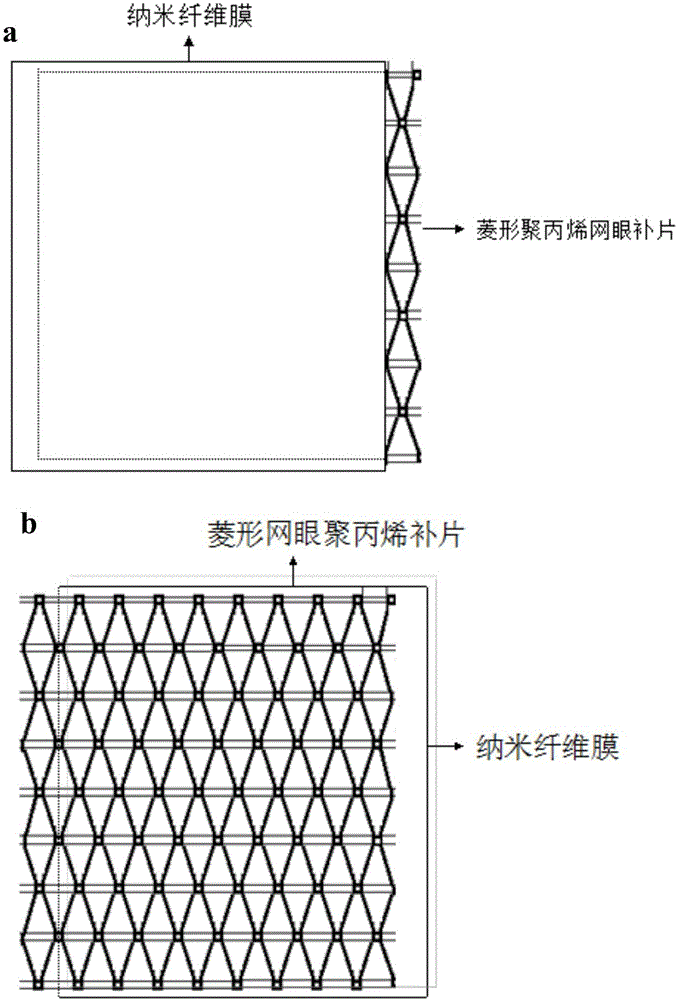 Electrostatic-spun coated composite pelvic mesh and manufacturing method thereof