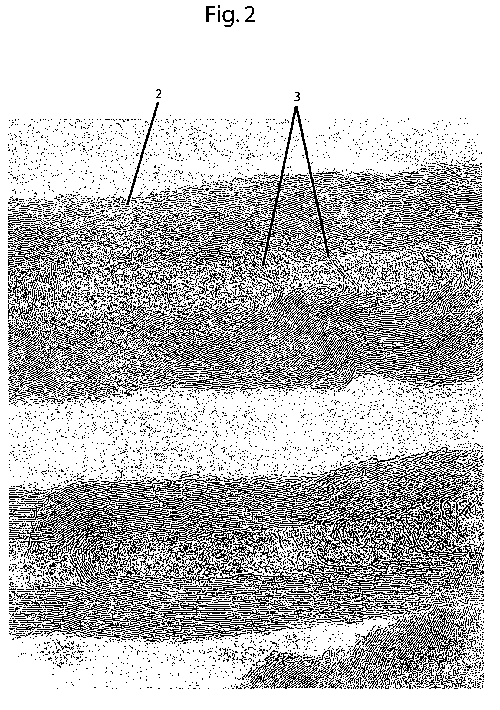 Negative electrode active material for an electricity storage device and method for manufacturing the same