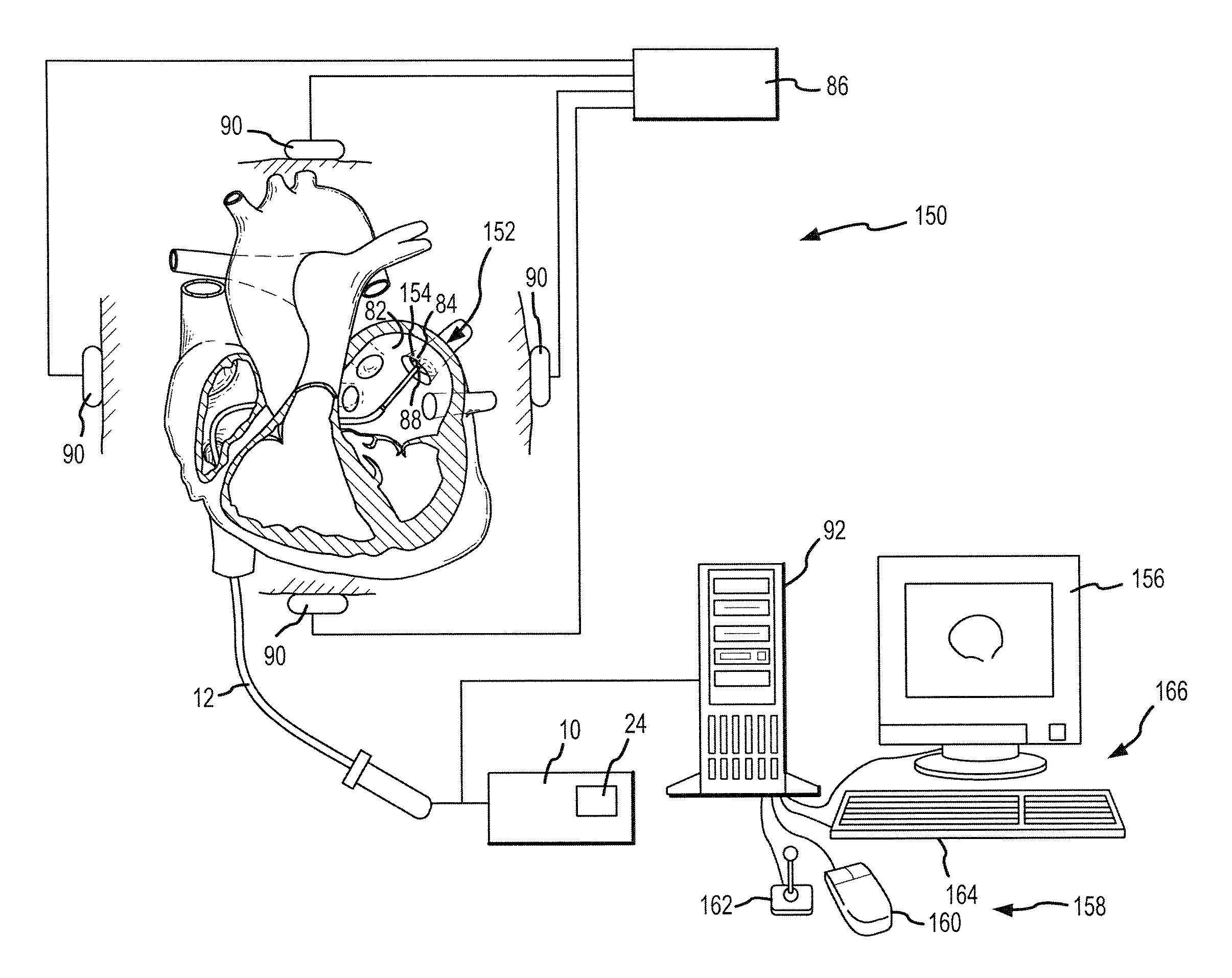 Robotic surgical system and method for automated therapy delivery