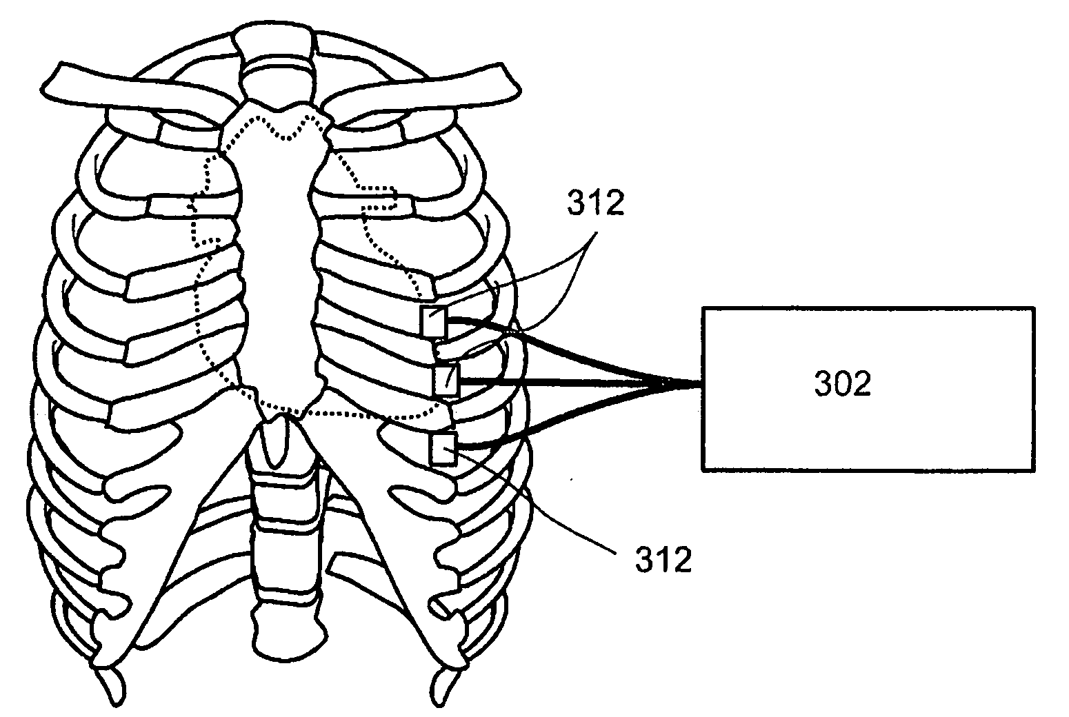 Non-invasive cardiac parameter measurement