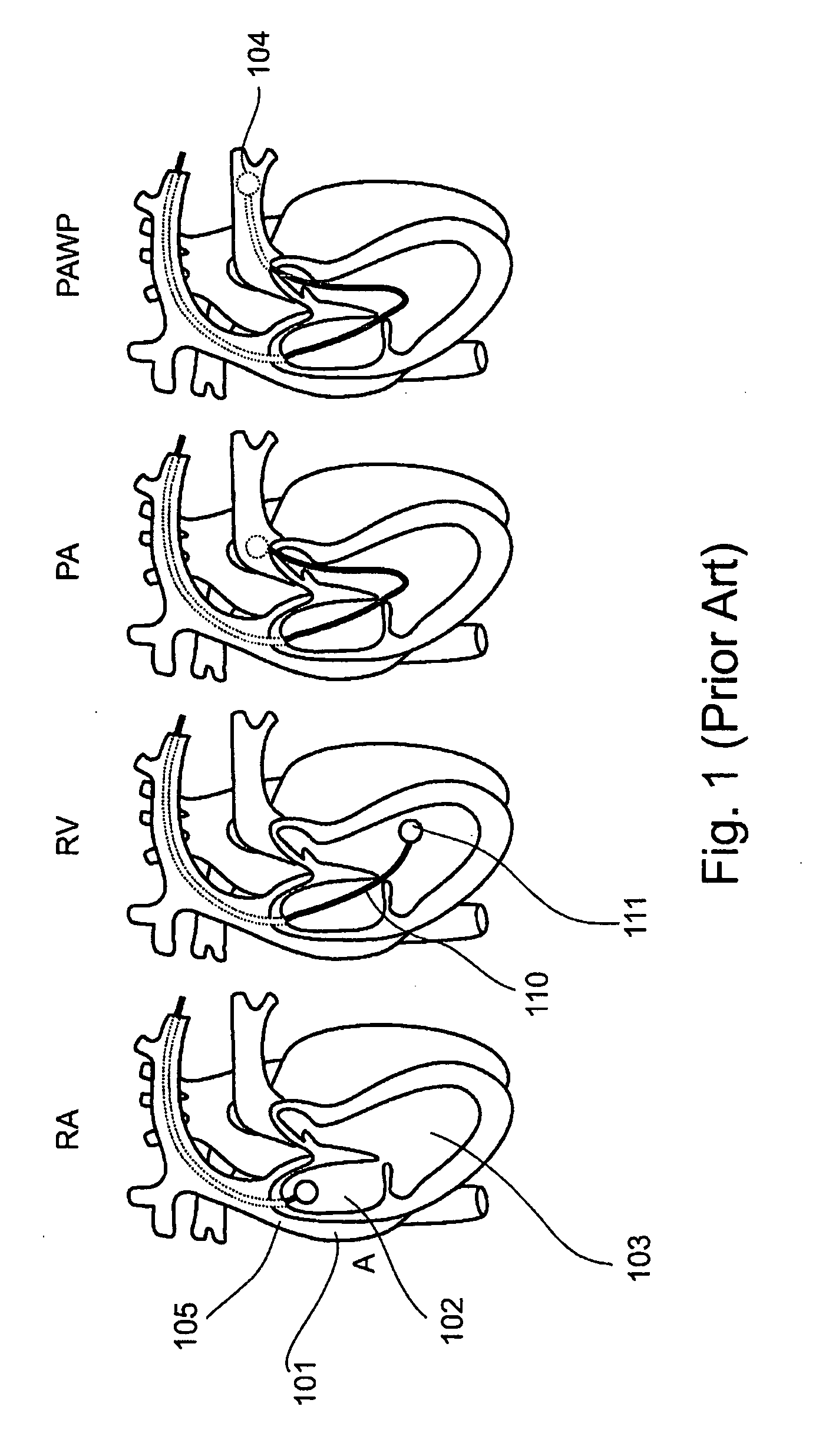 Non-invasive cardiac parameter measurement