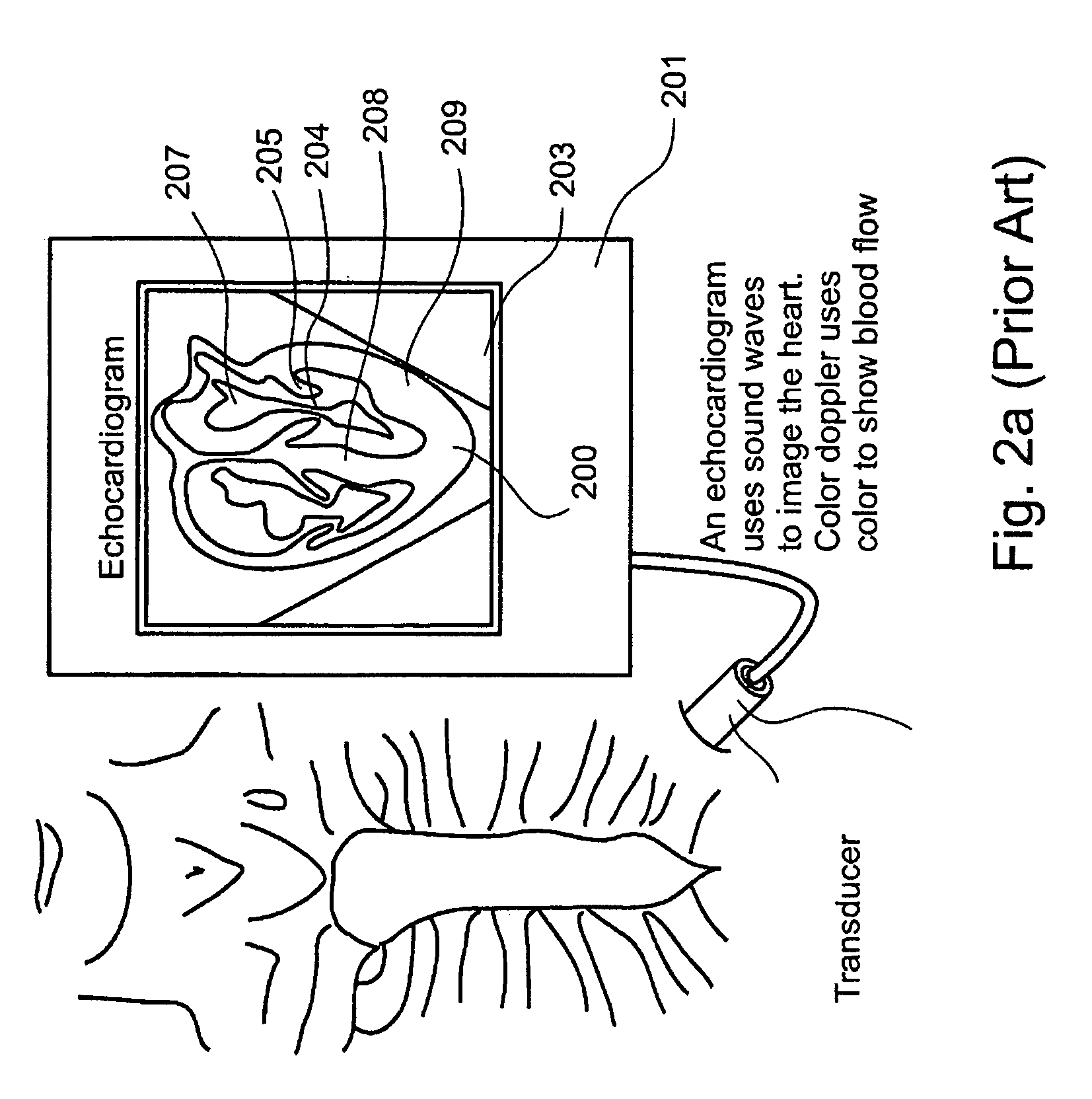 Non-invasive cardiac parameter measurement