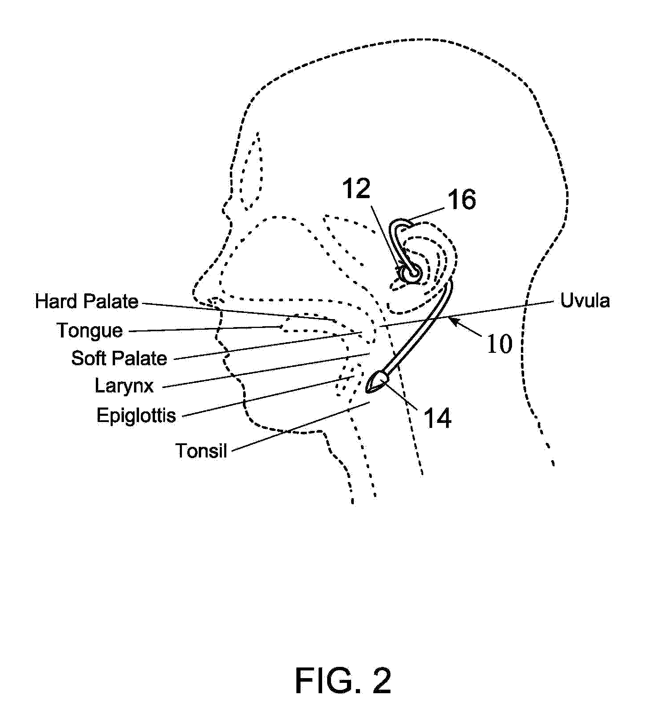 Device for the treatment of sleep-related conditions