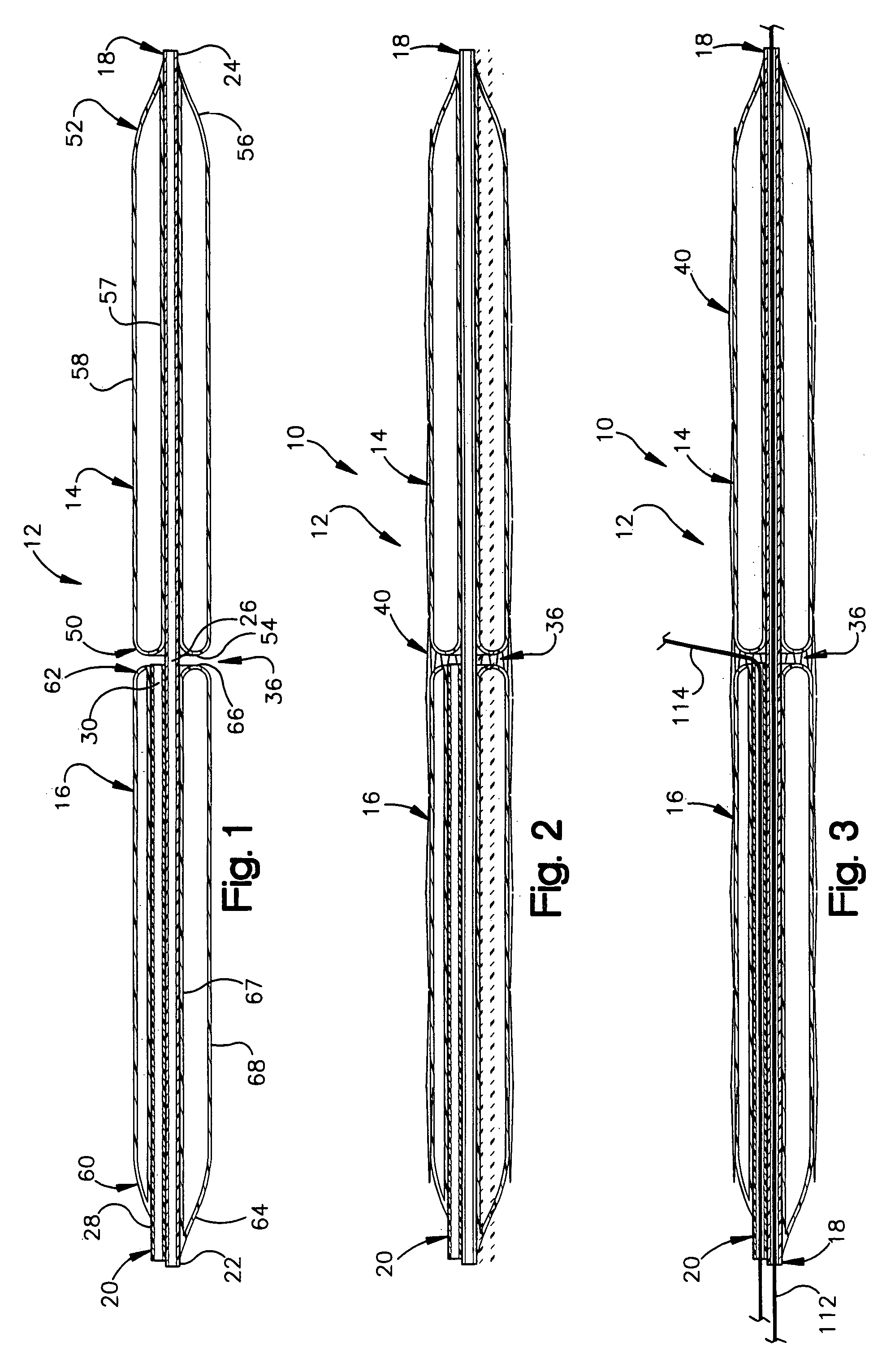 Apparatus for treating atherosclerosis