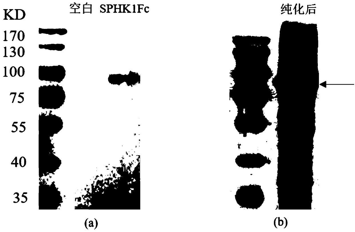 Sphingosine kinase 1 and its fusion protein and application