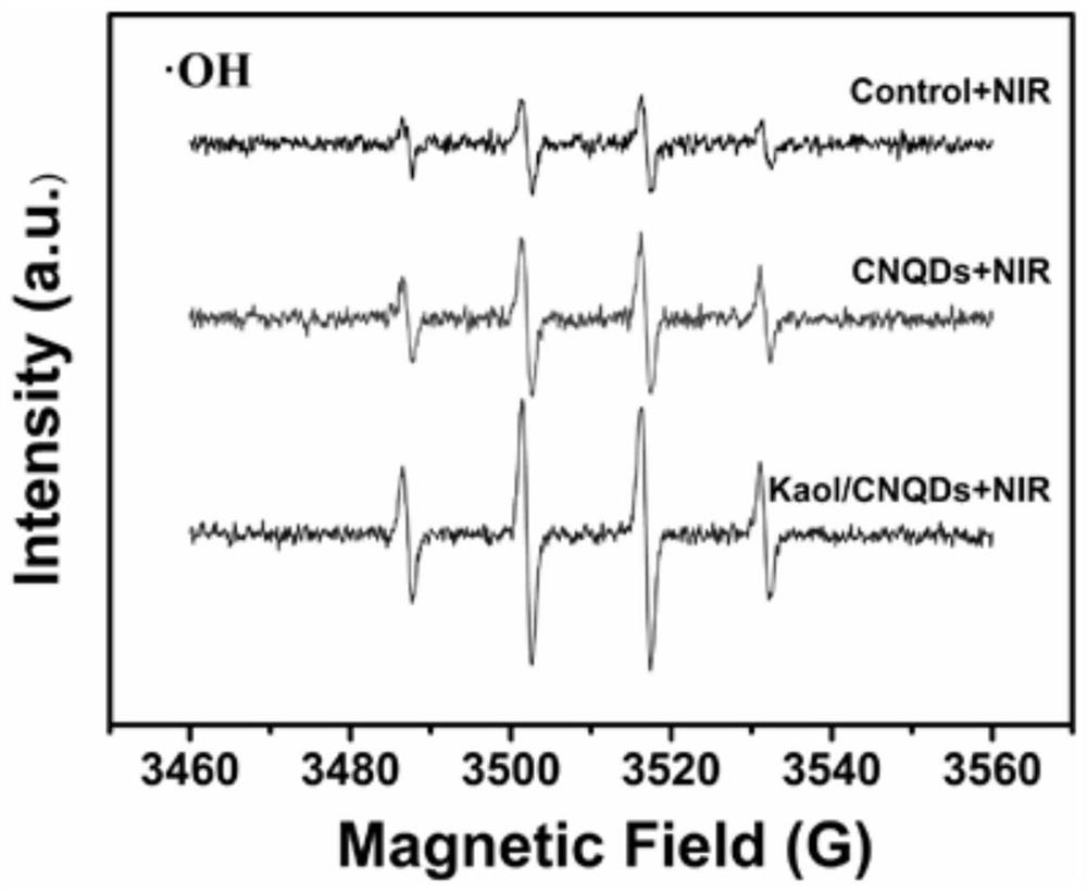 Composite kaolinite diagnosis and treatment agent as well as preparation method and application thereof