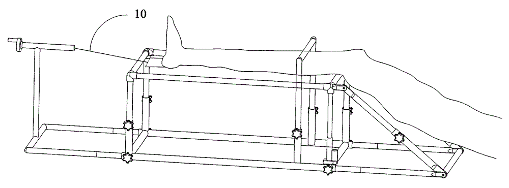 Shank fracture traction reduction frame