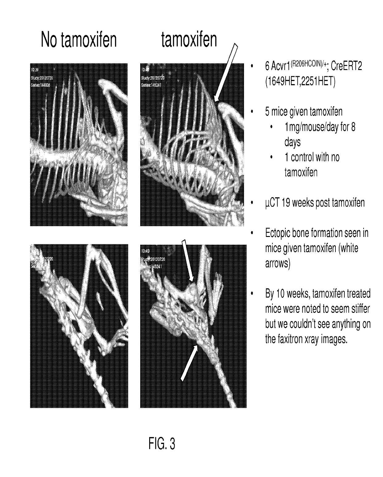 Method for making a genetically modified mouse with an inducible ACVR1 mutation that causes ectopic bone formation