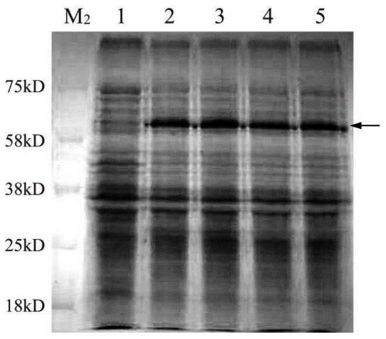 Use of Kin17 gene or protein in preparation of cervical cancer diagnosis and treatment medicaments