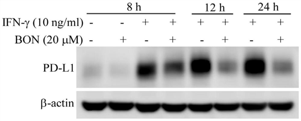 Application of bleomycin in inhibition of PD-L1 high-expression tumors