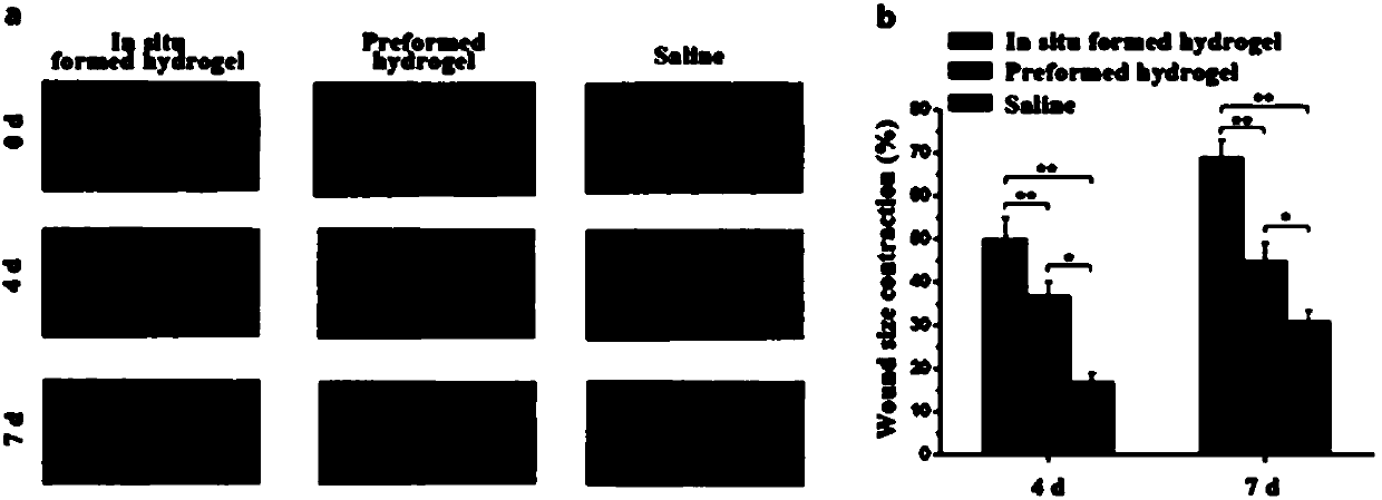 Preparation, raw material, product and application of photo-coupling co-crosslinking hydrogel material