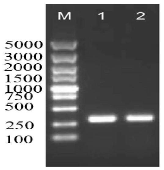 Tibetan anagrus cantoniensis odorant binding protein gene sequence and application thereof