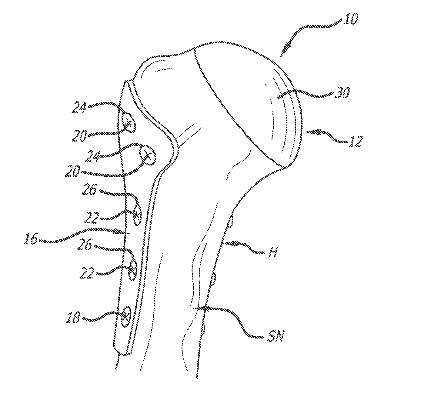 System and method for fracture replacement of comminuted bone fractures or portions thereof adjacent bone joints