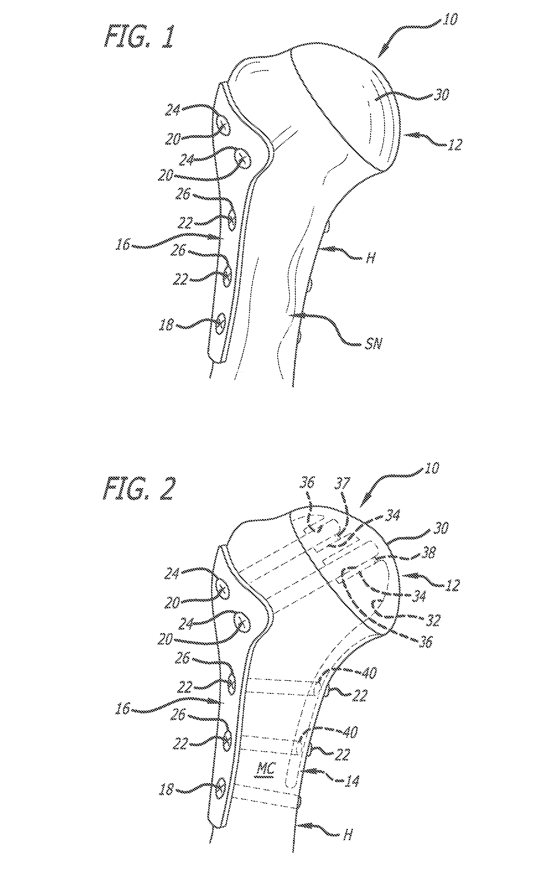 System and method for fracture replacement of comminuted bone fractures or portions thereof adjacent bone joints