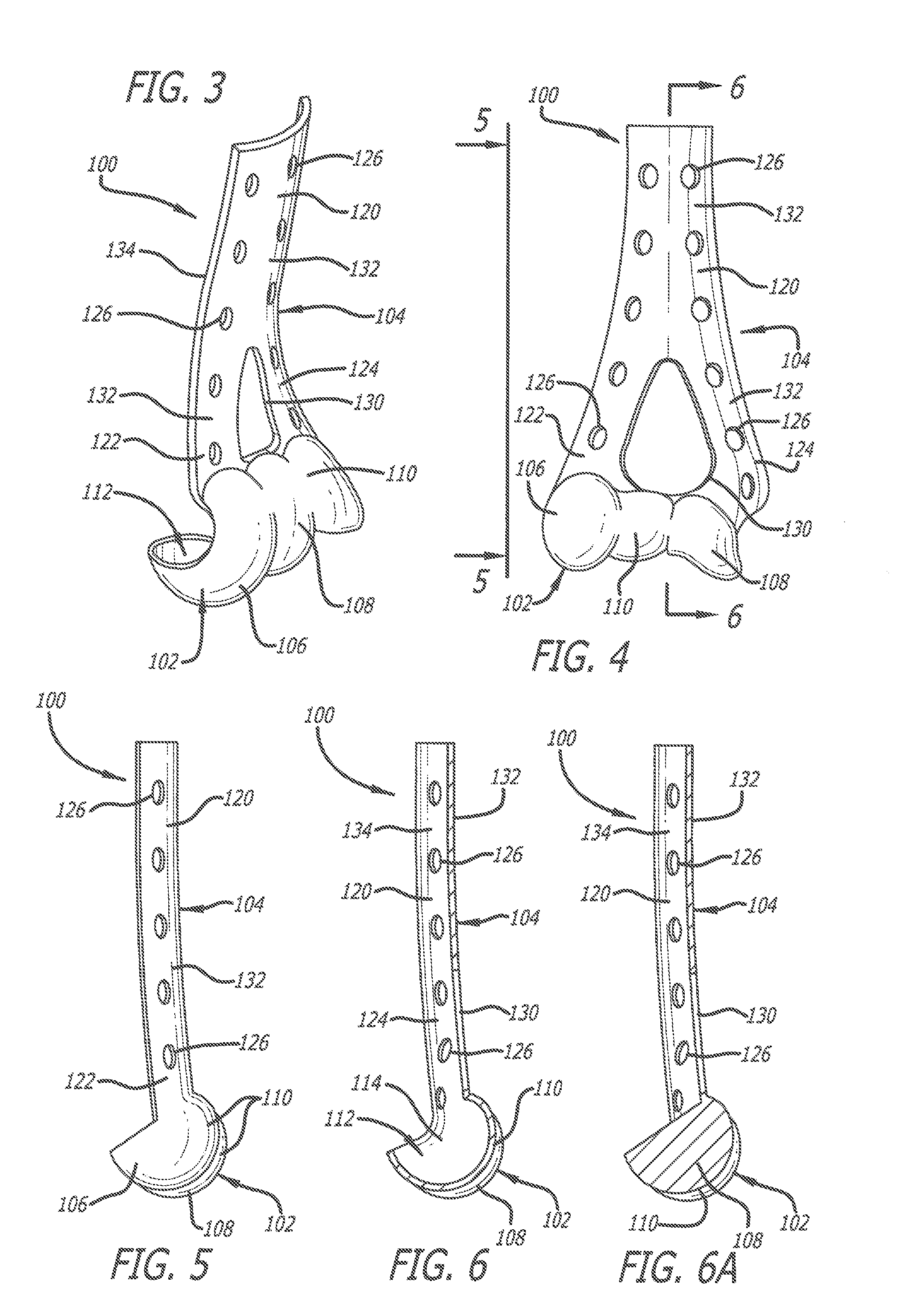 System and method for fracture replacement of comminuted bone fractures or portions thereof adjacent bone joints