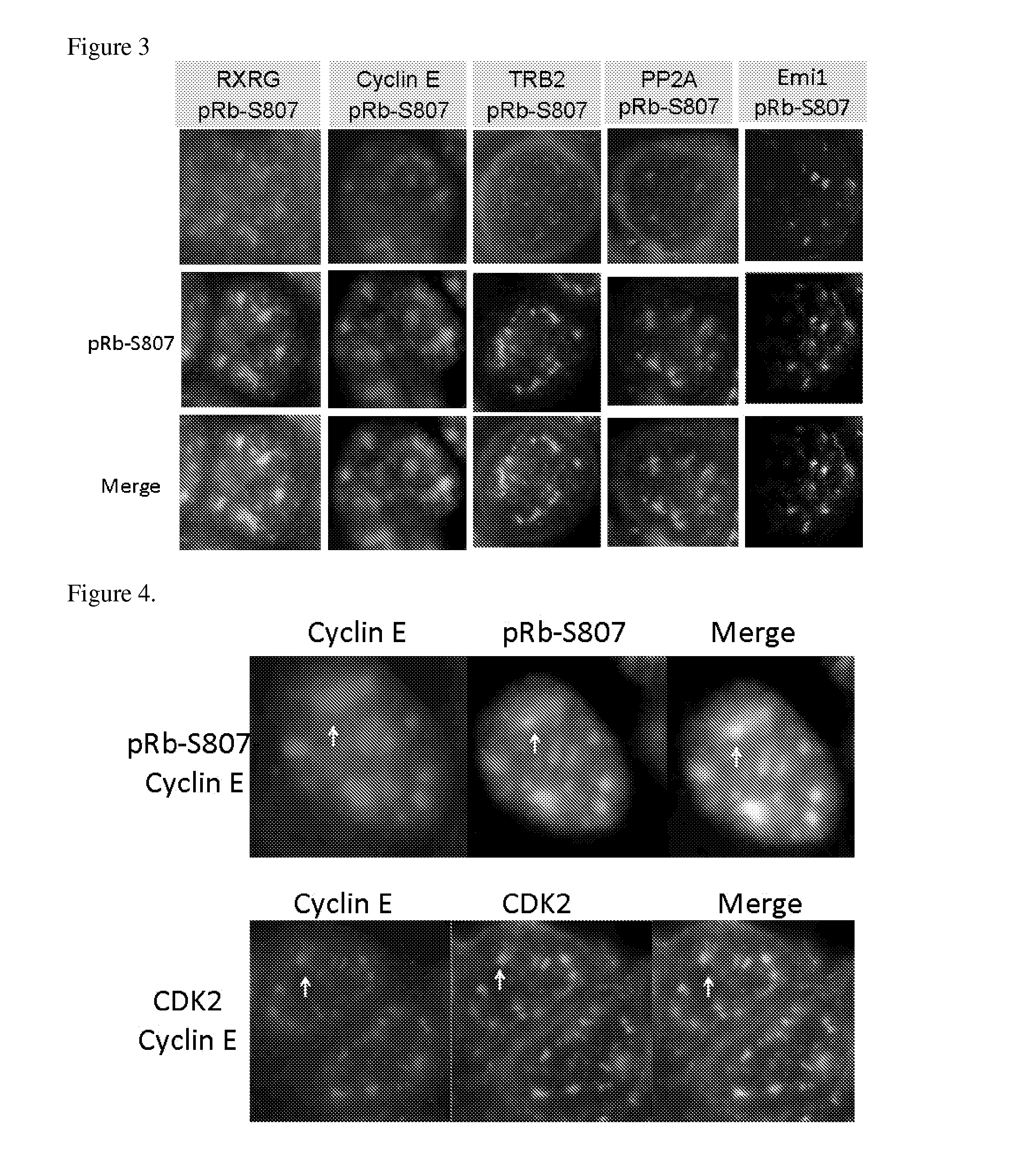 Rxrg modulators for the treatment of cancer