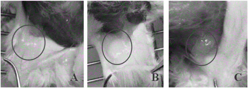 Paclitaxel slow-release temperature-sensitive gel and preparation method thereof