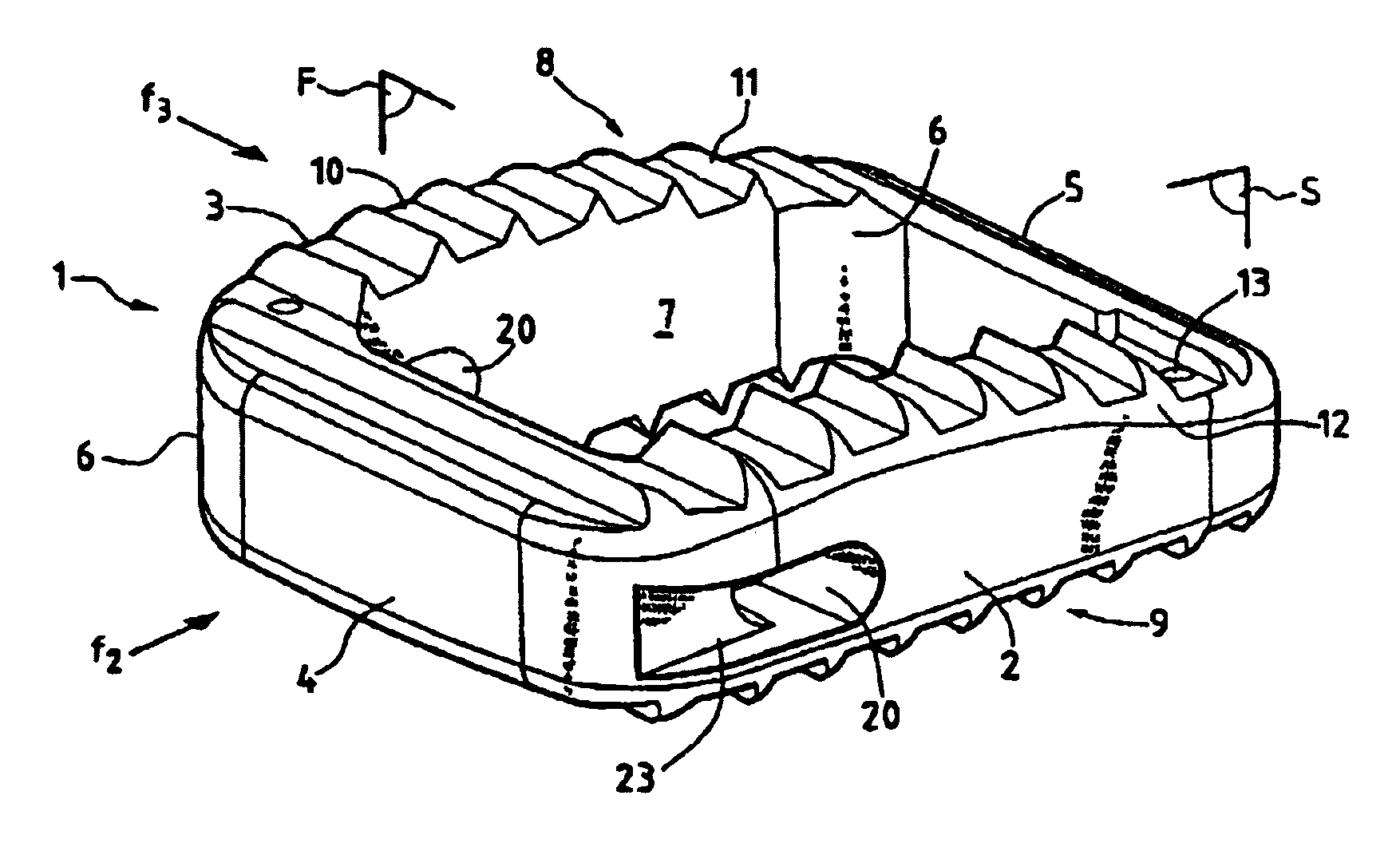 Anatomical interbody implant and gripper for same