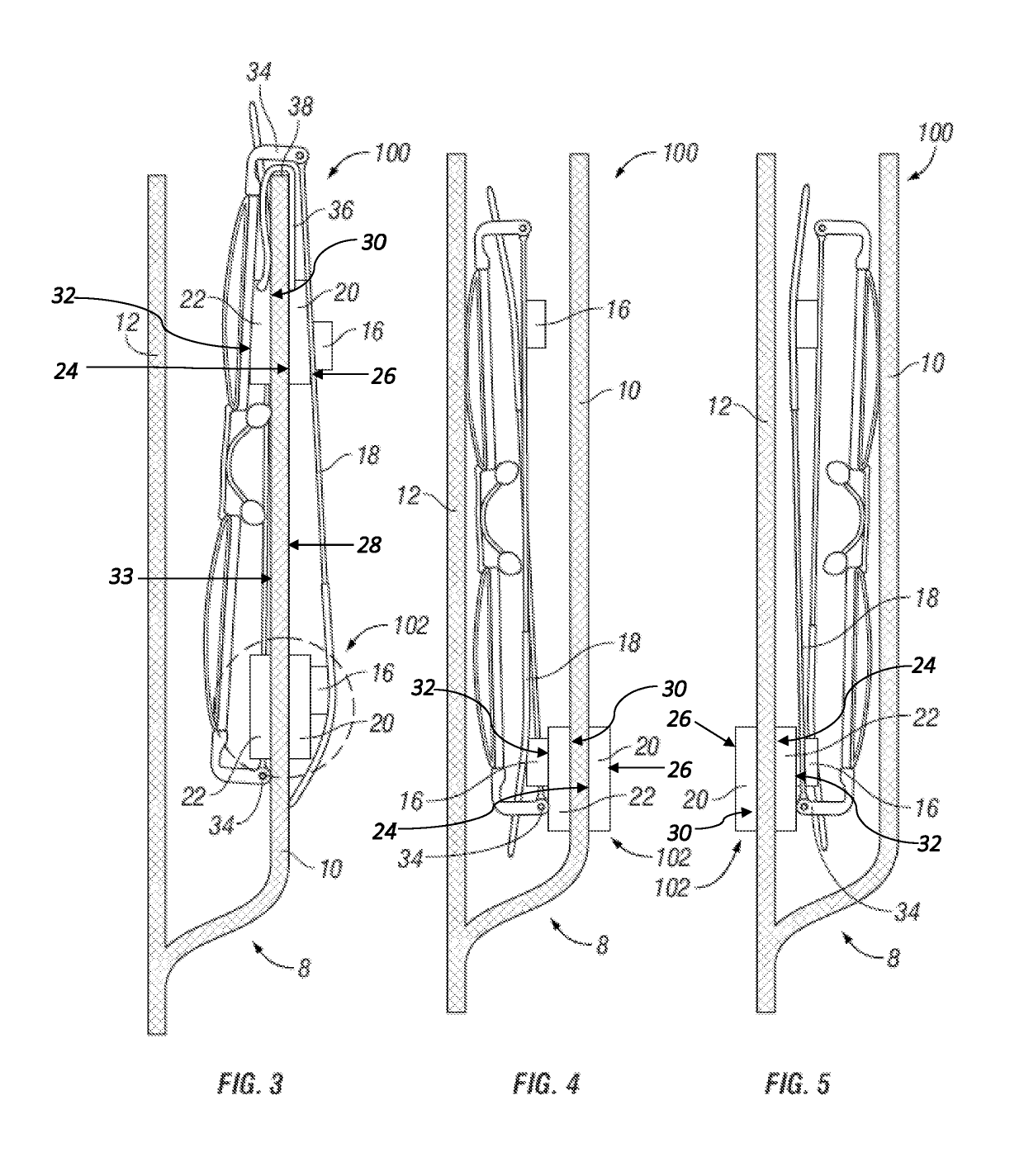 Method and apparatus for retaining eyeglasses