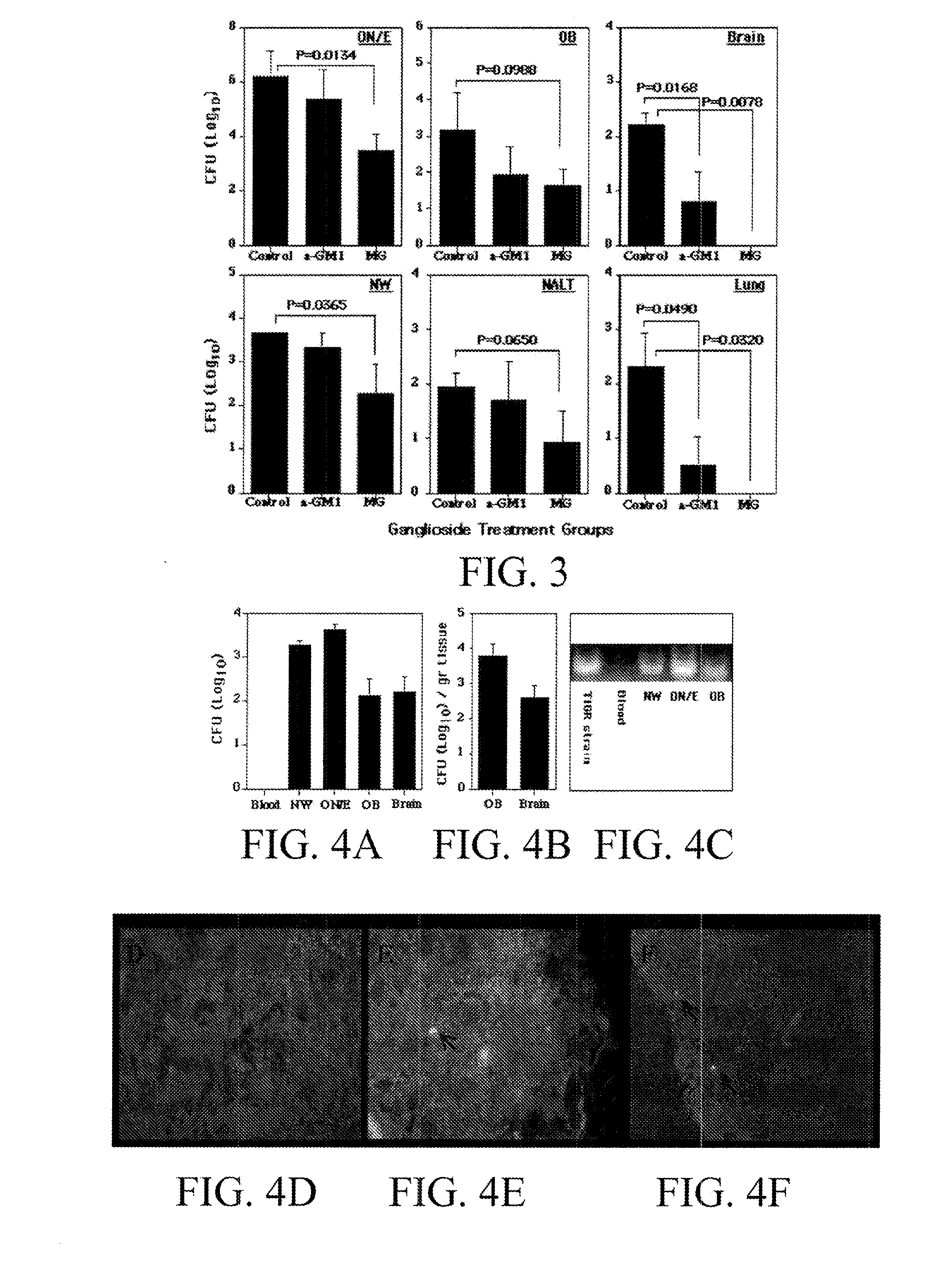 Detoxified pneumococcal neuraminidase and uses thereof