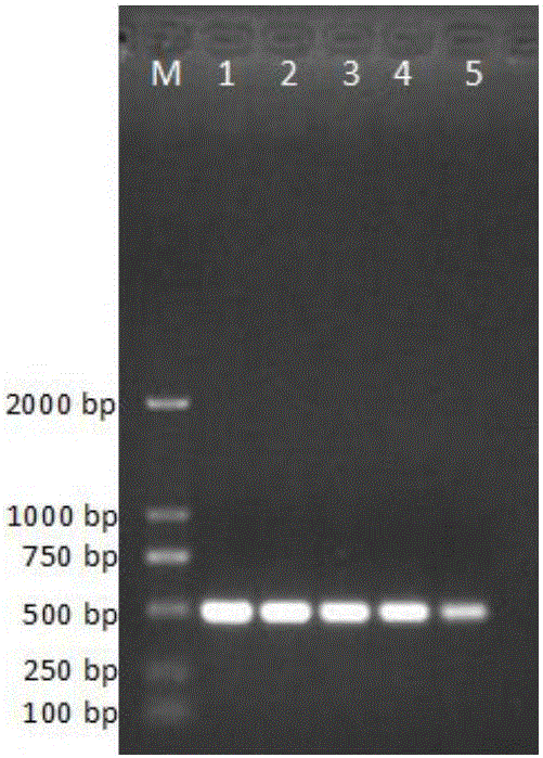 PCR detection method for vibrio alginolyticus in aquaculture animal body