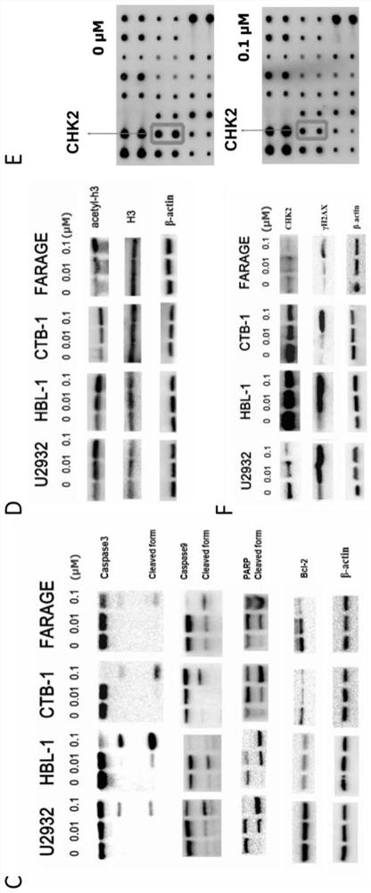 Application of novel HDAC inhibitor LAQ824 to drug for treating diffuse largeB-cell lymphoma